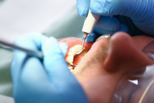 Best Tooth Pain Emergency Relief  in Walled Lake, MI