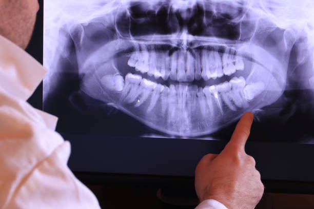 Best Broken Tooth Emergency  in Walled Lake, MI
